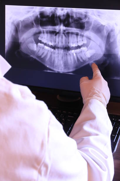 Best Emergency Dental Extractions in Glenwood, IL